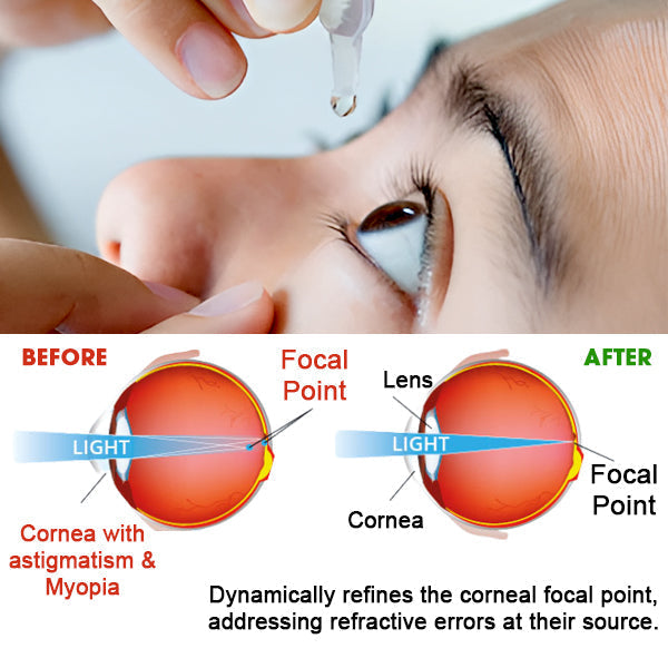 💥 2025 Limited 70% OFF ️⏳ Kolirin Eye Care Drops