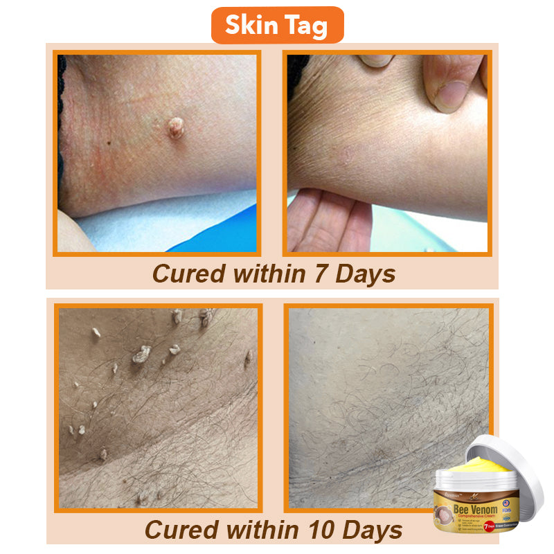 šš Bee Venom Comprehensive Cream šŗšø America Dermatologist Recommended