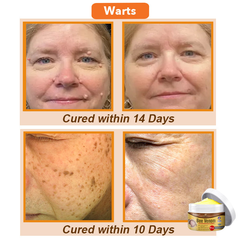 šš Bee Venom Comprehensive Cream šŗšø America Dermatologist Recommended